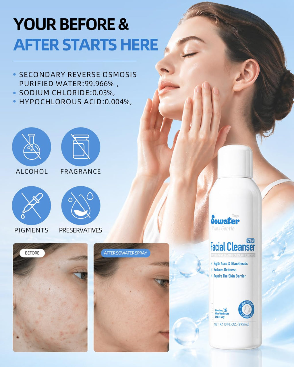 Hypochlorous Acid Facial Mist 10 oz Z578